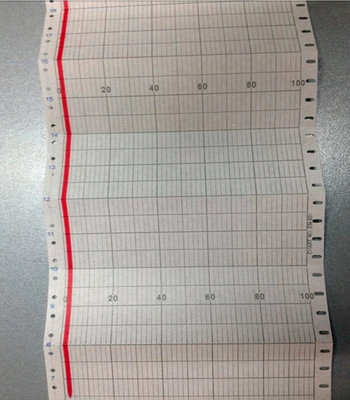 Chart paper EL05081 for CHINO AL,EL,EM Series Z-FOLD CHART 100mm (114mm) recording paper EL05081 supplier