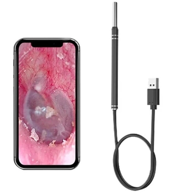 Intelligent Visual Ear Picker with APP supplier